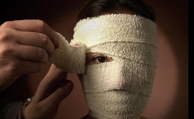 جراحی پلاستیک